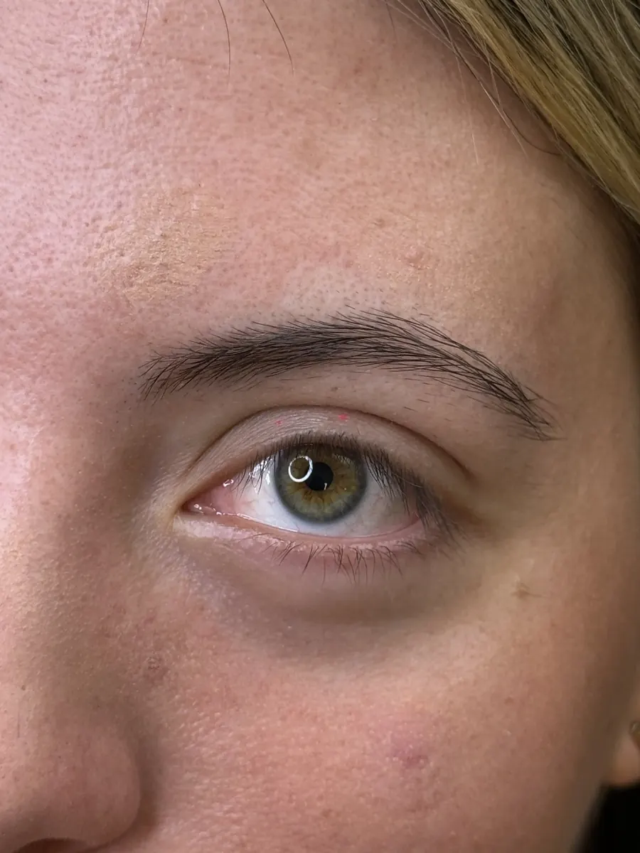 Ojo natural antes del tratamiento en Anabel Beauty Care