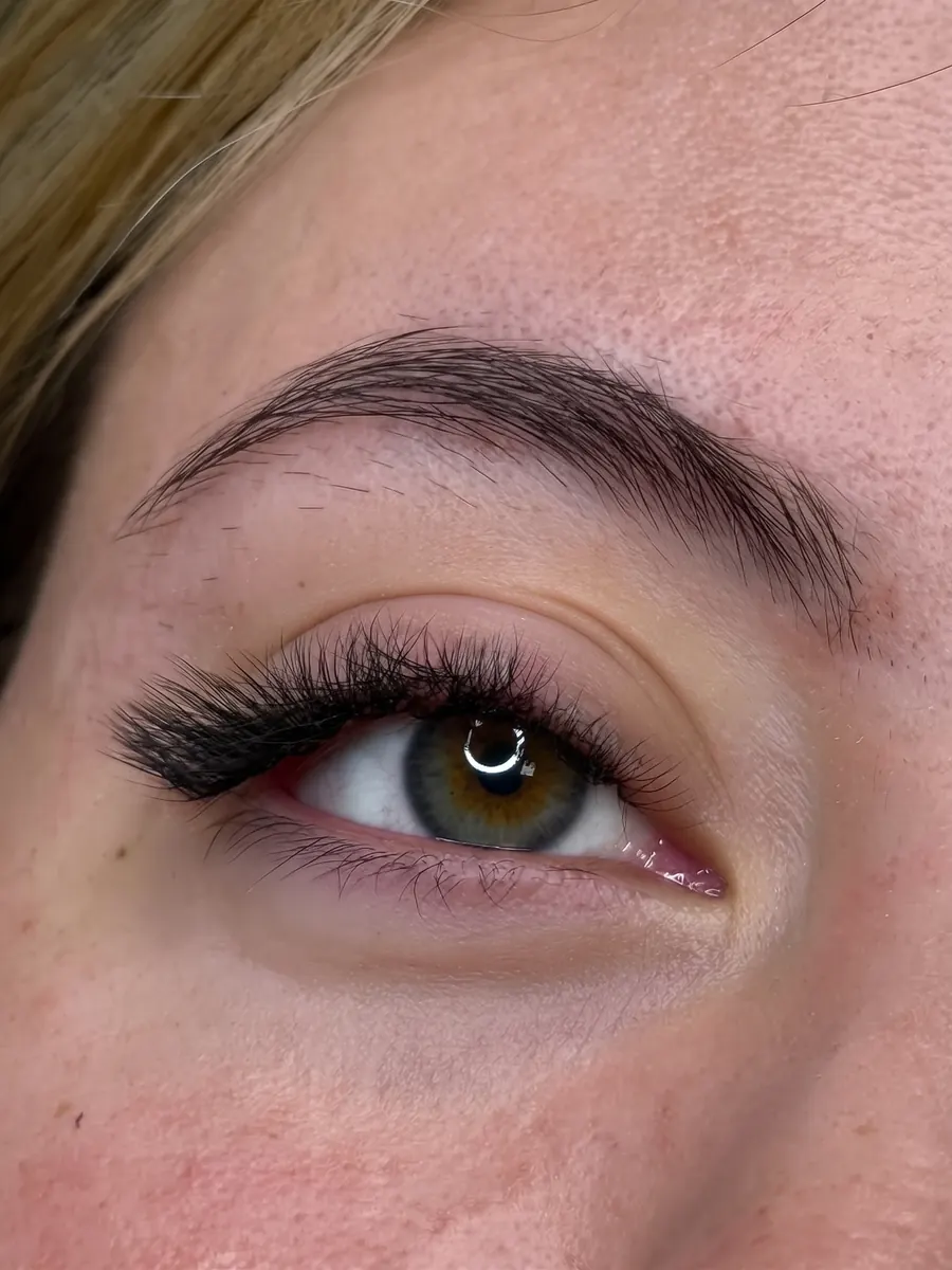Resultado después del tratamiento en Anabel Beauty Care
